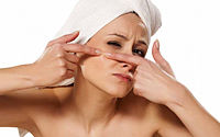 Get the best Acne Treatment in Mumbai - Dermatologistmumbai.com.jpg
