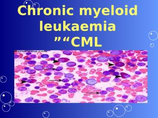 Chronic myeloid leukaemia عرض عن اللوكيميا  2010.pptx